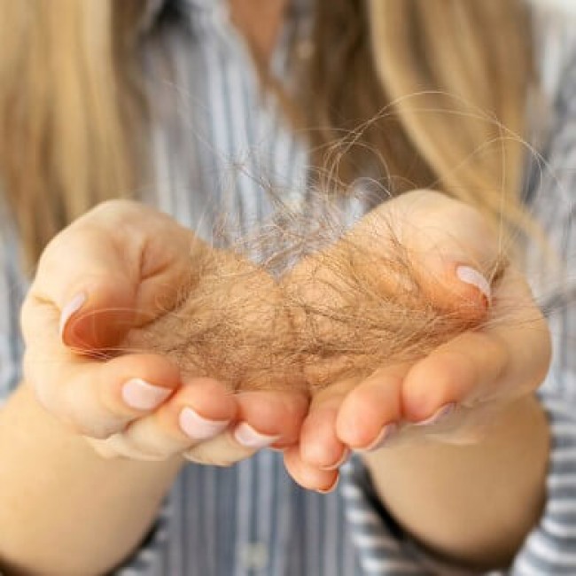 De 5 bedste vitaminer mod hårtab - forebyg dit hårtab