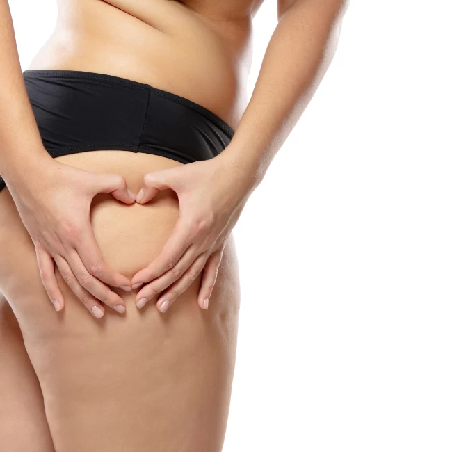 Sådan slipper du af med appelsinhud på lårene