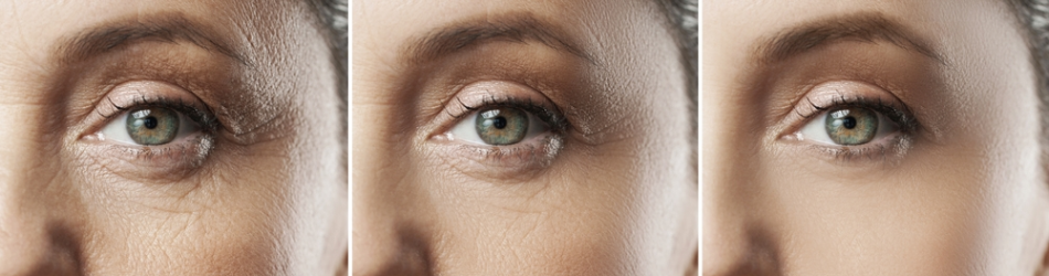 Kollagen type 1 er perfekt til at pleje huden. Kollagen type 1 er perfekt til at pleje huden.